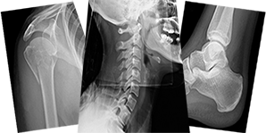 Trauma X-ray Interpretation- Whole Skeleton - Certificated Course Completion Assessment - Buy Now