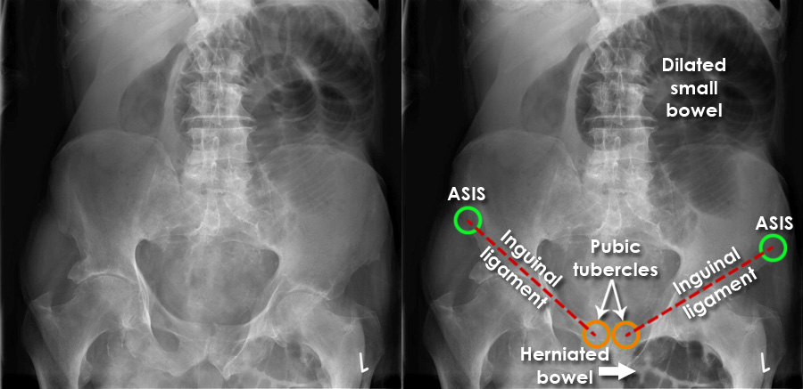 asis-radiology