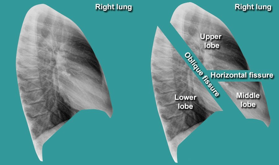 Lung Lobes lung-lobes
