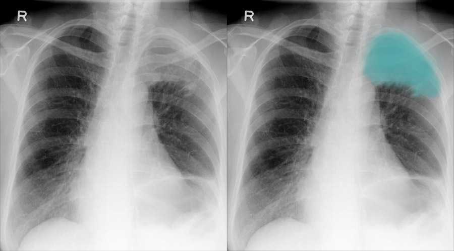 Chest X-ray Systematic Approach - The clinical question