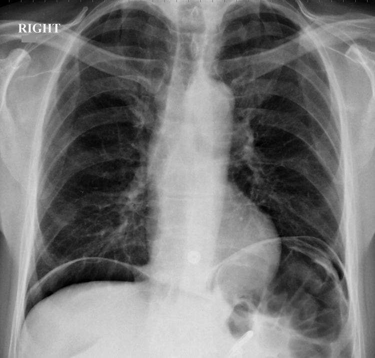 Radiology Masterclass Test Yourself Abdominal Xray Quiz