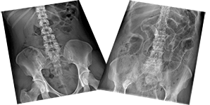 Abdominal X-ray Interpretation - Certificated Course Completion Assessment - Buy Now