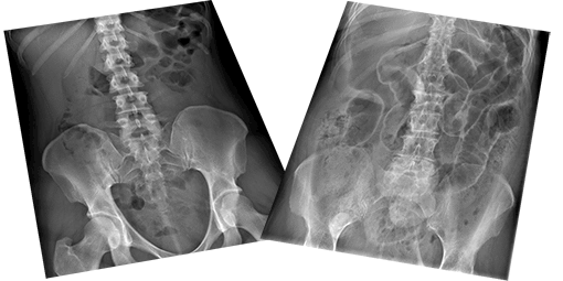 Abdominal X-ray X-ray Interpretation - Certificated Course Completion Assessment - Buy Now Abdominal X-ray X-ray Interpretation - Certificated Course Completion Assessment - Buy Now
