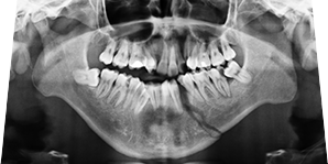 Trauma X-ray Interpretation - Axial Skeleton - Certificated Course Completion Assessment - Buy Now