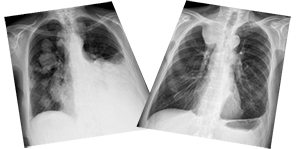 Chest X-ray Interpretation - Certificated Course Completion Assessment - Buy Now