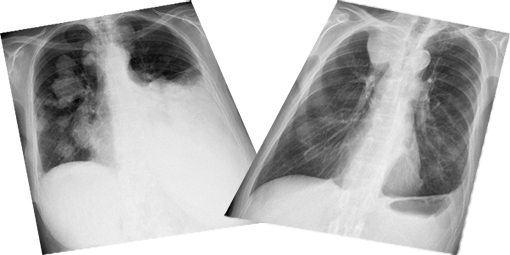Chest X-ray Interpretation - Certificated Course Completion Assessment - Buy Now