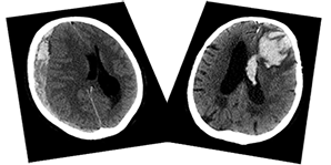 Acute CT Brain - Certificated Course Completion Assessment - Buy Now