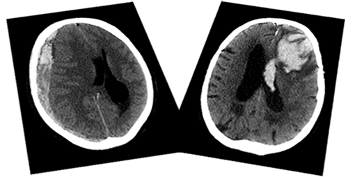 Acute CT Brain - Certificated Course Completion Assessment - Buy Now