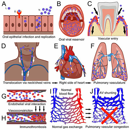 oro-vascular-pulmnary-covid