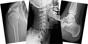 Trauma X-ray Interpretation - Whole Skeleton - Certificated Course Completion Assessment - Buy Now