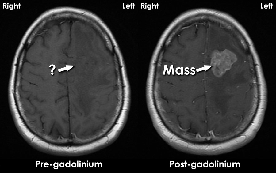 is-it-safe-to-be-in-the-mri-room-printable-online