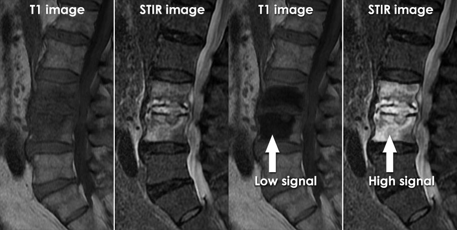 Mri Sequences Sequence Classification E Mri Vrogue co mri-sequences-sequence-classification-e-mri-vrogue-co