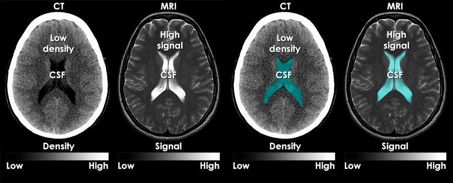 MRI image interpretation