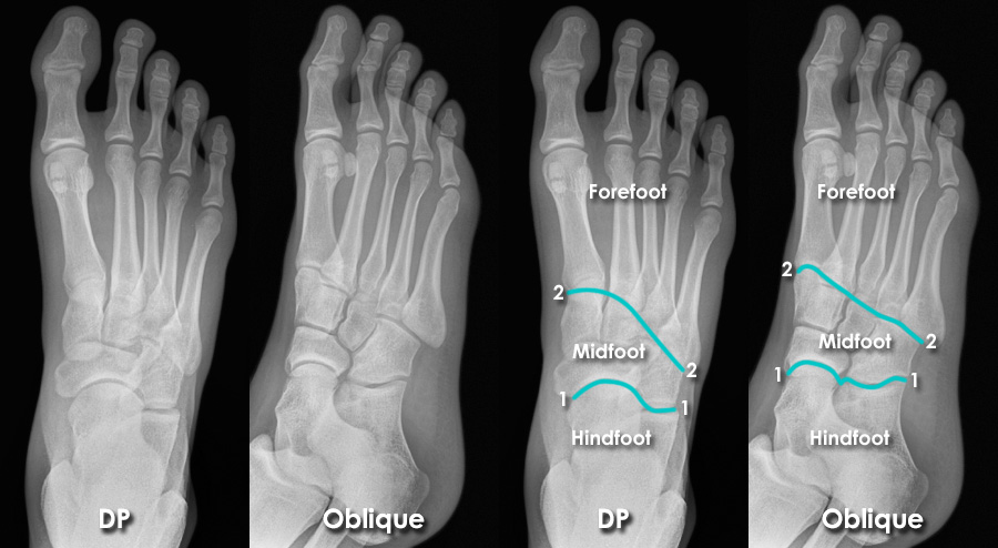 radiology-anatomy-practice-test-100-questions-with-answers-and