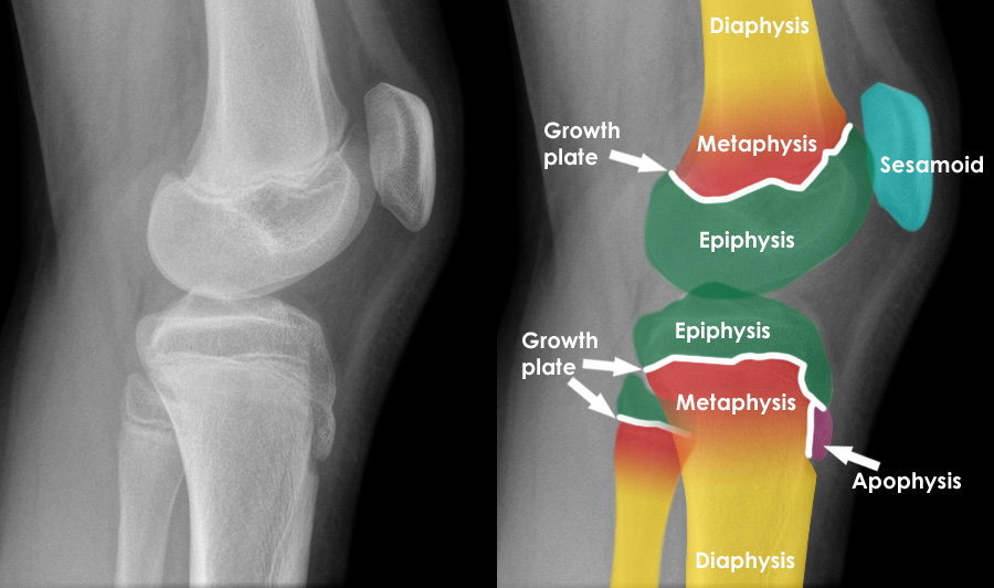 Musculoskeletal X-ray - General principles - Bone anatomy