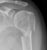 humerus_prox_a1_thumb.jpg