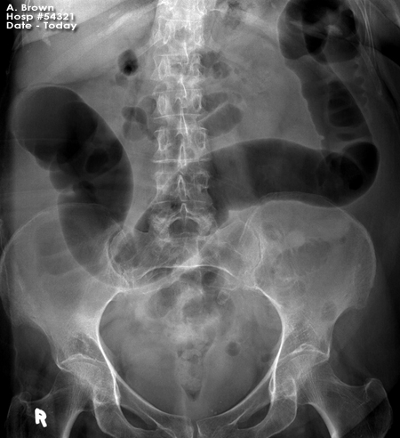 abdominal OSCE 1 image