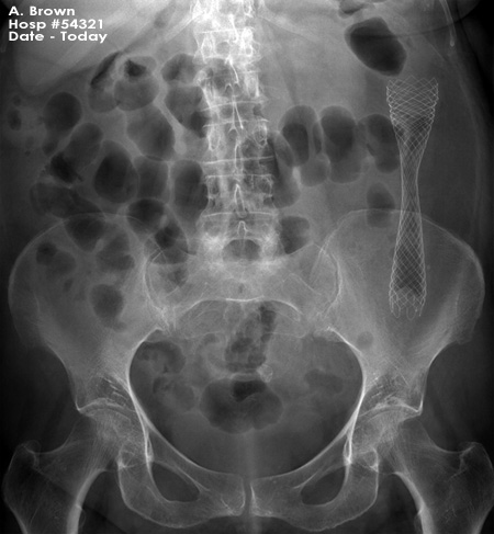 abdominal OSCE 1 image