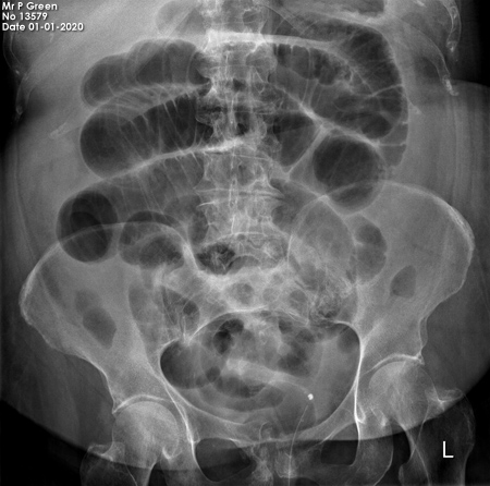 abdominal OSCE 2 image