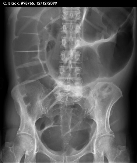 abdominal OSCE 3 image
