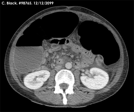 abdominal OSCE 3 image