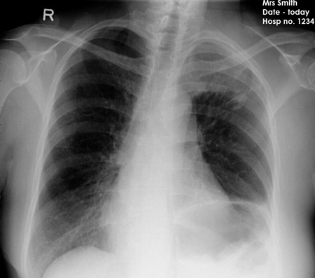 chest OSCE 1 image