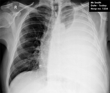 chest OSCE 2 image