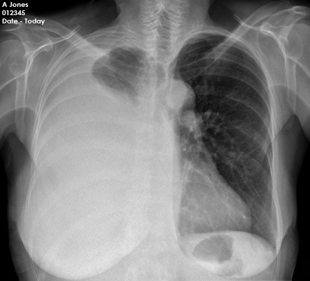 chest OSCE 3 image