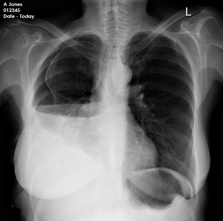 chest OSCE 3 image