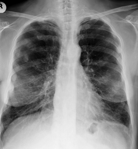 chest OSCE 4 image