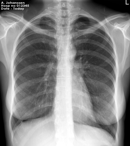 chest OSCE 5 image