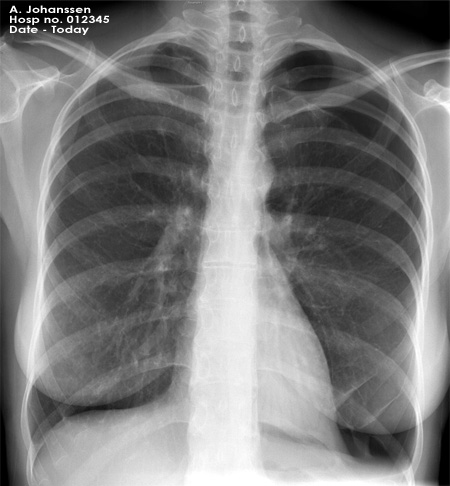 chest OSCE 5 image