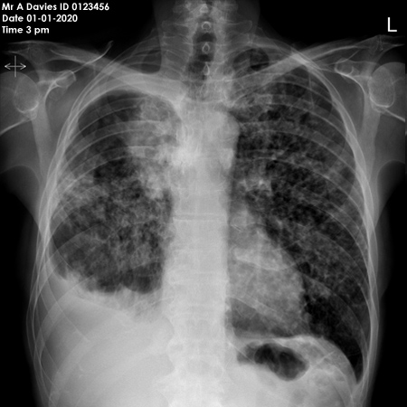 chest OSCE 6 image