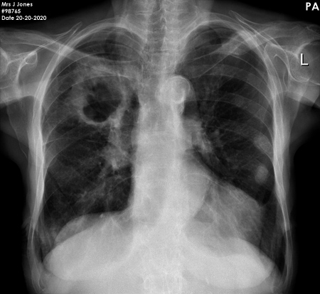 chest OSCE 7 image