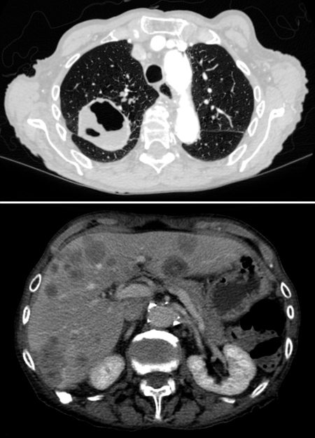 chest OSCE 7 image